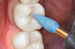 94020C dental bur
